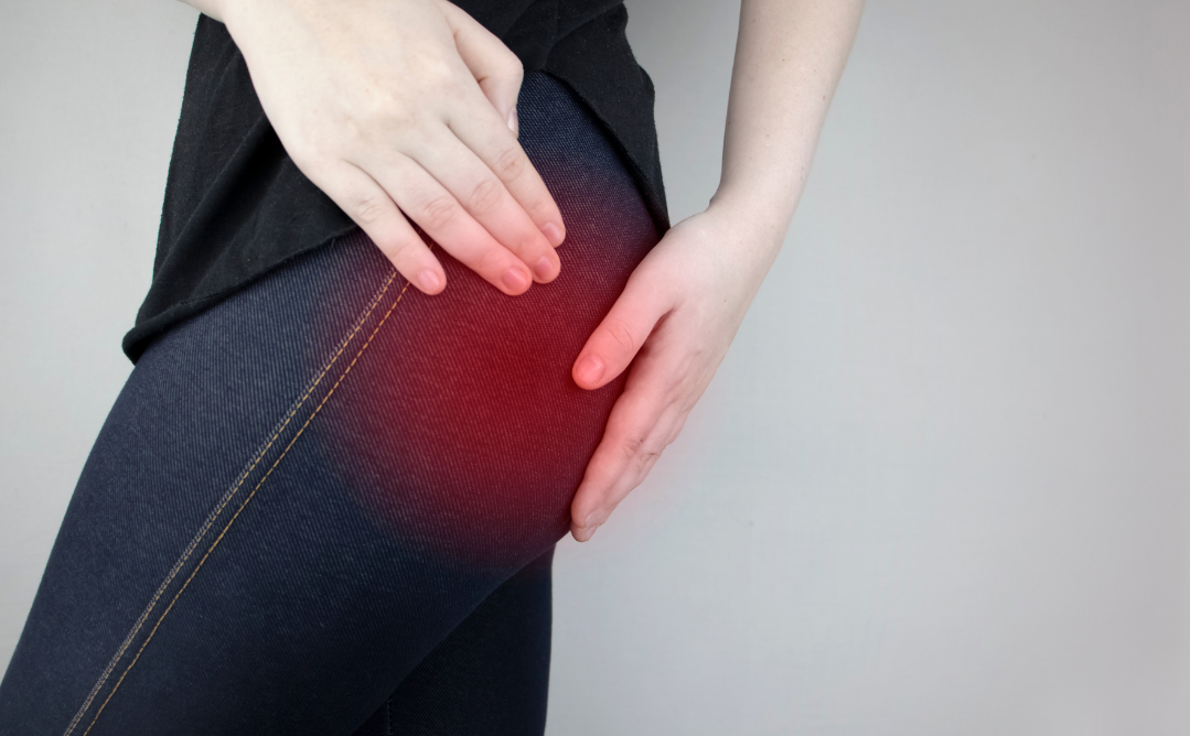 Piriformis Syndrome - Running Is a Pain in the Butt | Active PT & Sports